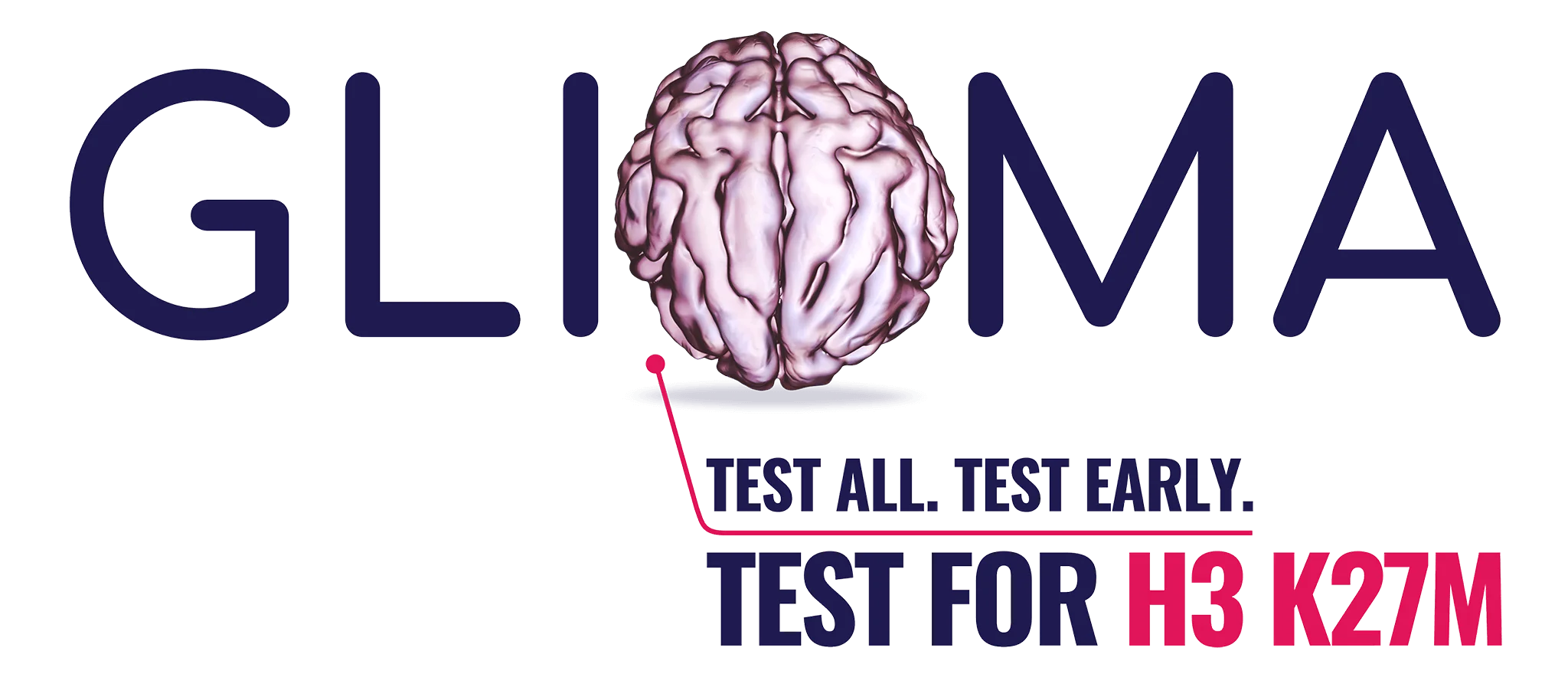 Stylized GLIOMA hero with a brain image as the O indicating the importance of testing for H3 K27M mutation in all diffuse gliomas